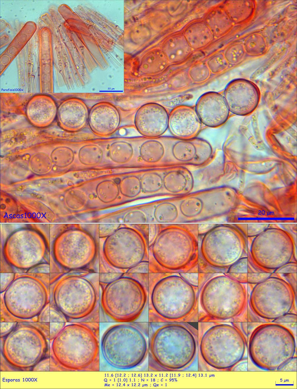 Pithya vulgaris microscopía