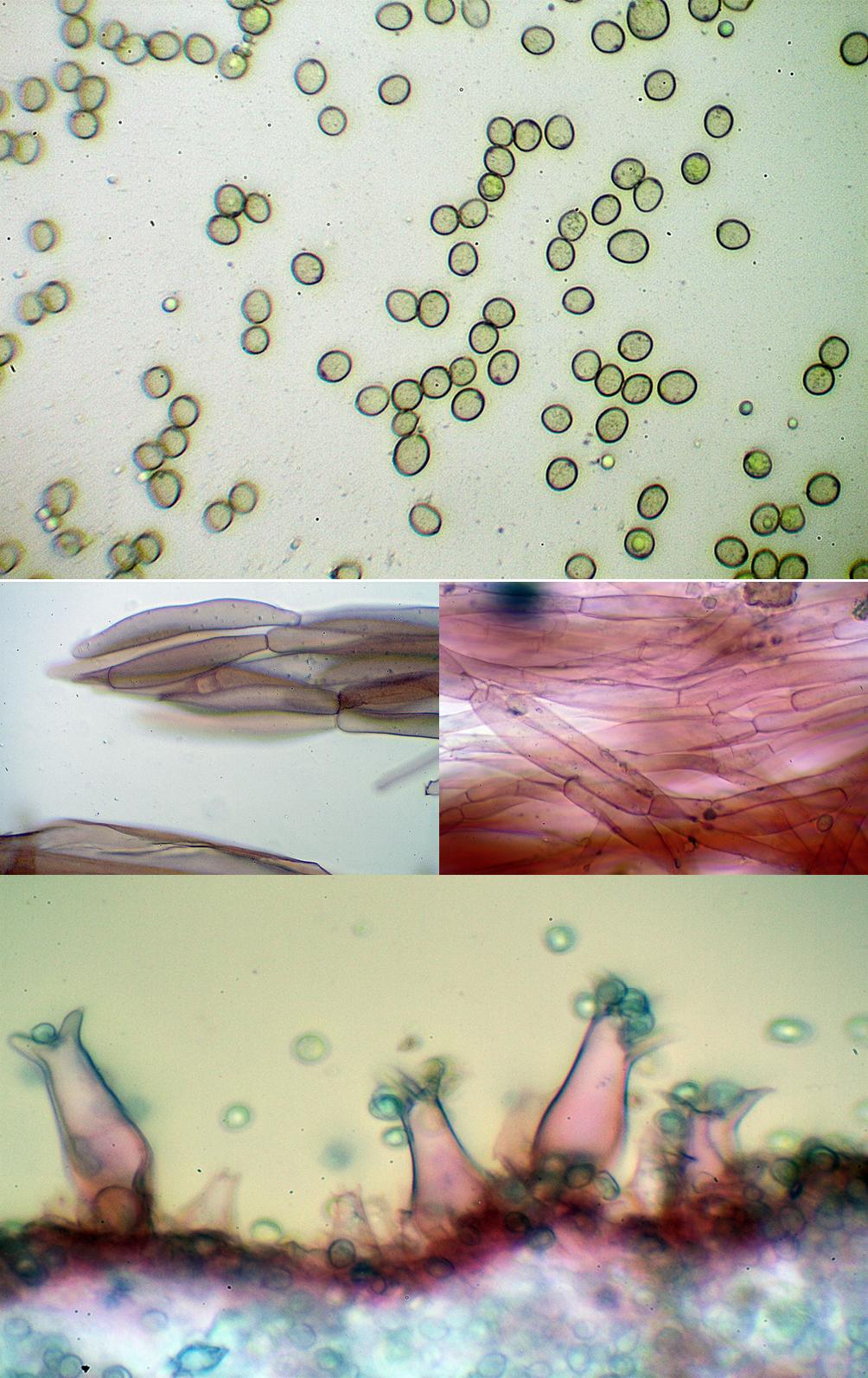Pluteus petasatus microscopía