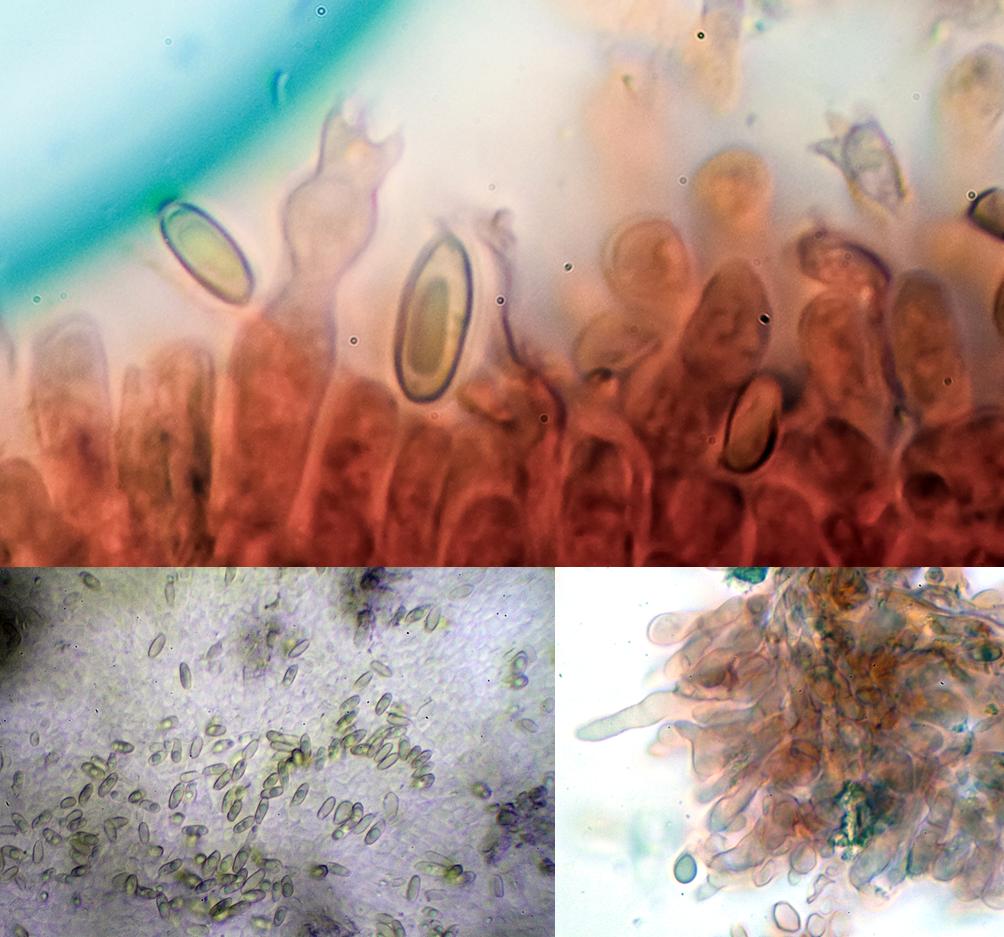 Suillus bovinus microscopía