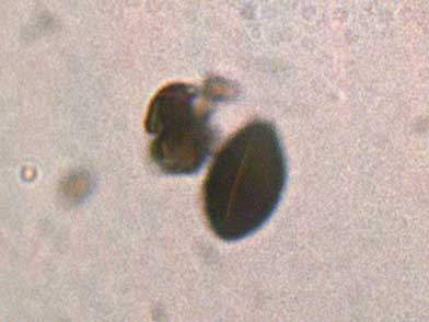 Espora con poro germinativo de Biscogniauxia nummularia
