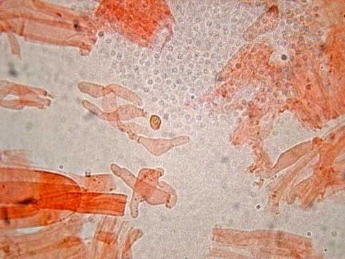 Caulocistidios de Conocybe aeruginosa