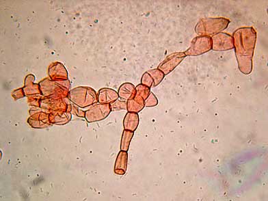 Cadena de hifas de la cutícula de Helvella ephippium