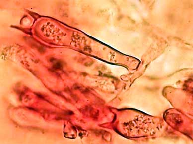 Basidios de Armillaria tabescens