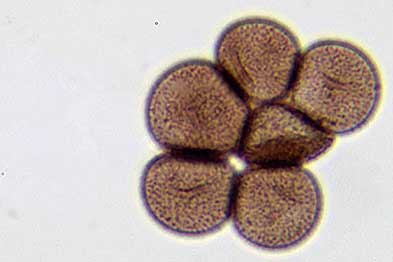 Microscopía de Physarum bogoriense
