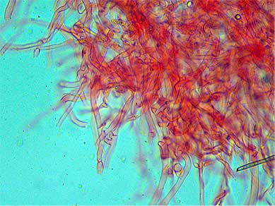 Pilleipelis con Rojo Congo